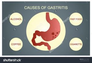 stock-vector-the-main-causes-of-gastritis-alcohol-fast-food-cigarettes-coffee-345217928