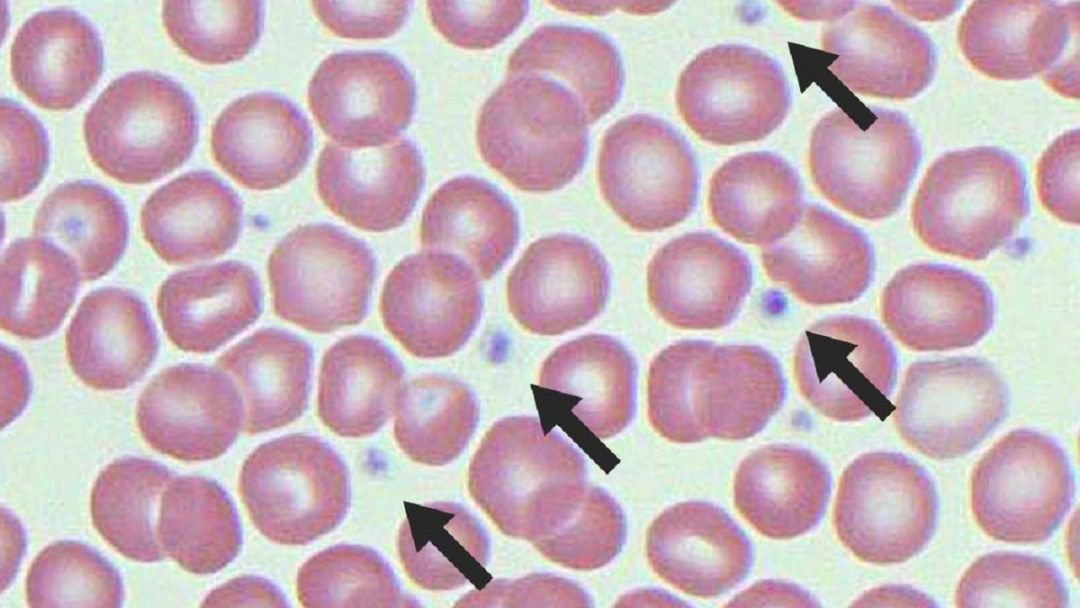 Sel Platelet Fungsi Cara Penghasilan And Penyakit Berkaitan